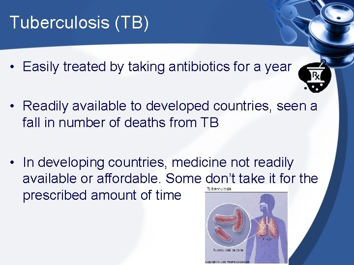 Tuberculosis (TB) • Easily treated by taking antibiotics for a year • Readily available