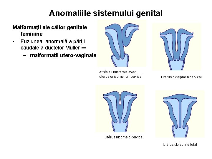 Anomaliile sistemului genital Malformaţii ale căilor genitale feminine • Fuziunea anormală a părţii caudale