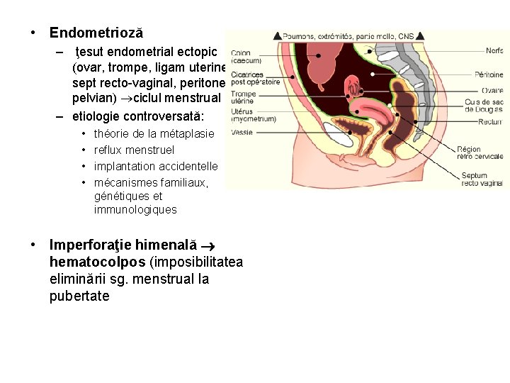  • Endometrioză – ţesut endometrial ectopic (ovar, trompe, ligam uterine, sept recto-vaginal, peritoneul