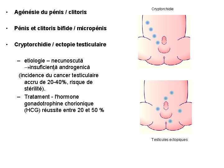  • Agénésie du pénis / clitoris • Pénis et clitoris bifide / micropénis