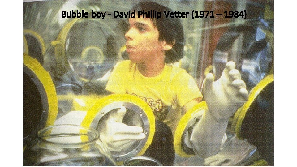 Bubble boy - David Phillip Vetter (1971 – 1984) 