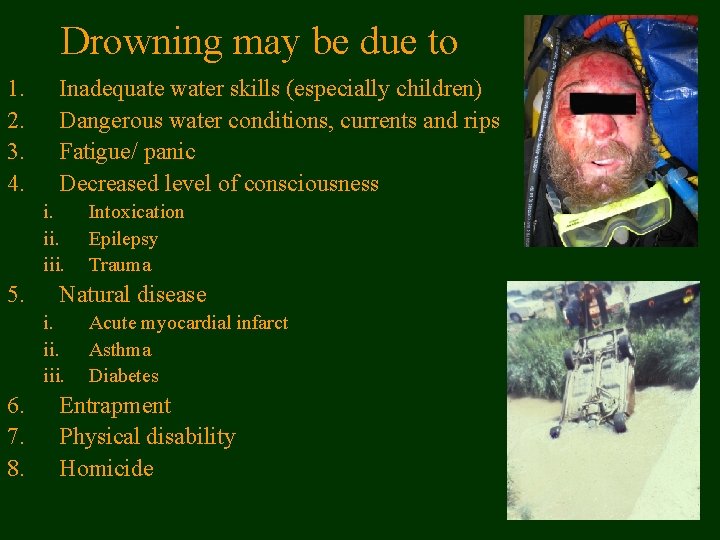 Drowning may be due to 1. 2. 3. 4. Inadequate water skills (especially children)