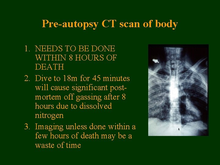 Pre-autopsy CT scan of body 1. NEEDS TO BE DONE WITHIN 8 HOURS OF