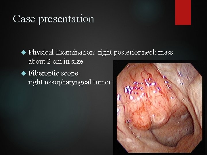 Case presentation Physical Examination: right posterior neck mass about 2 cm in size Fiberoptic