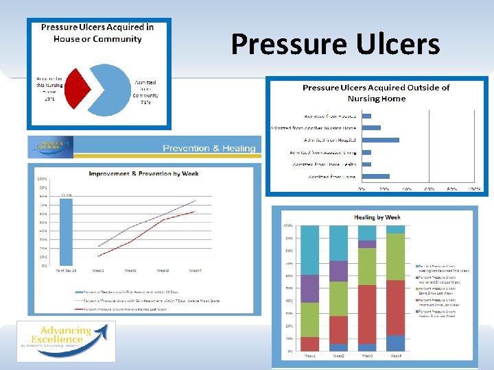 Pressure Ulcers 