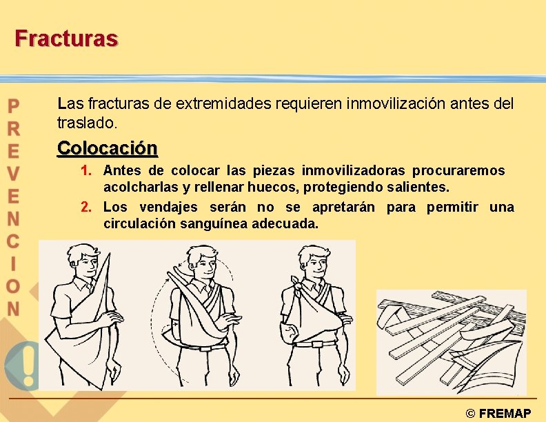 Fracturas Las fracturas de extremidades requieren inmovilización antes del traslado. Colocación 1. Antes de