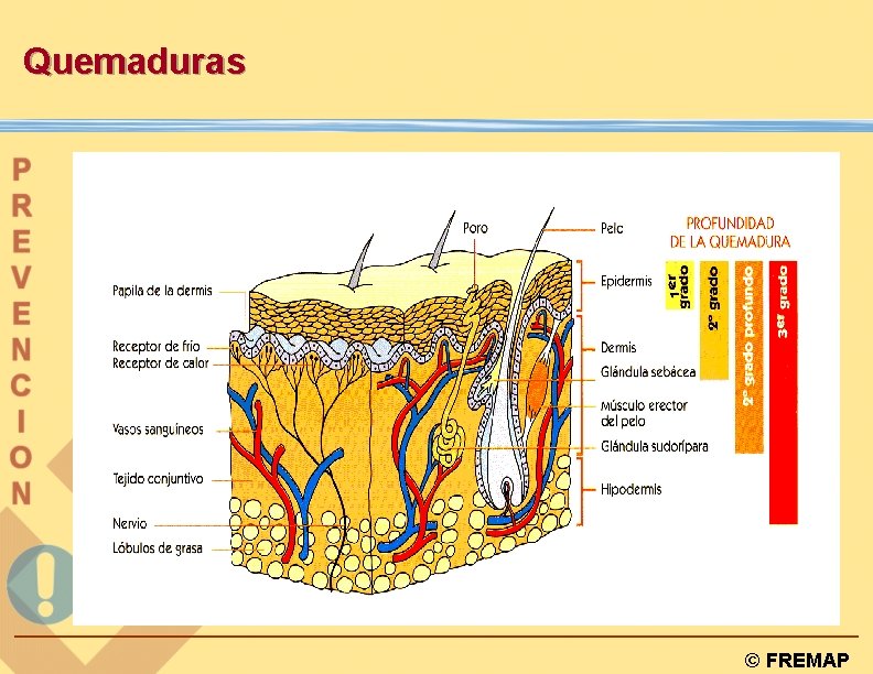 Quemaduras © FREMAP 