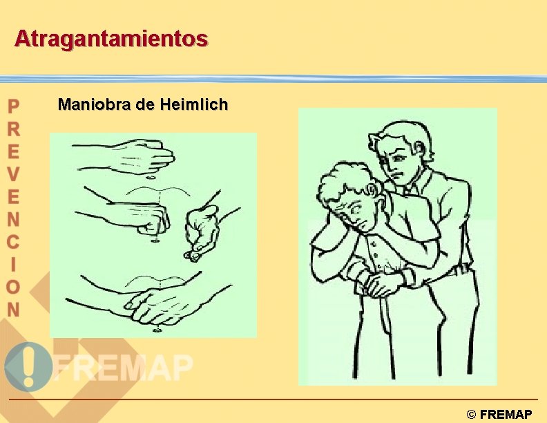 Atragantamientos Maniobra de Heimlich © FREMAP 