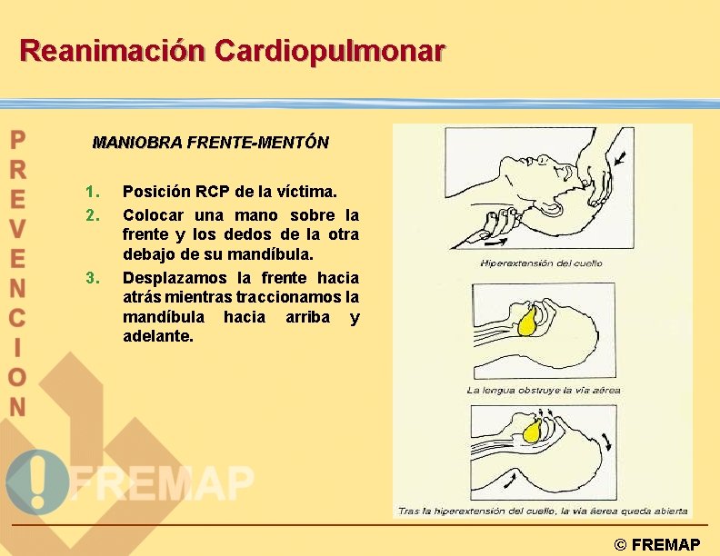 Reanimación Cardiopulmonar MANIOBRA FRENTE-MENTÓN 1. 2. 3. Posición RCP de la víctima. Colocar una