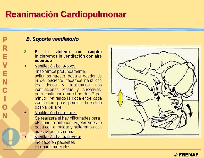 Reanimación Cardiopulmonar B. Soporte ventilatorio 3. w w w Si la víctima no respira