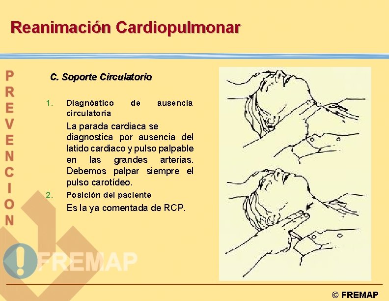 Reanimación Cardiopulmonar C. Soporte Circulatorio 1. Diagnóstico circulatoria de ausencia La parada cardiaca se