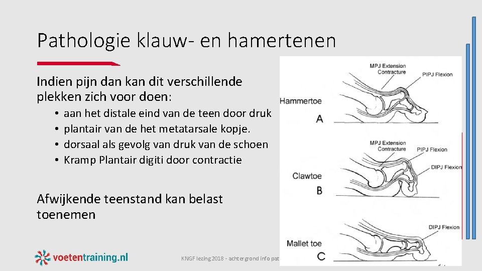 Pathologie klauw- en hamertenen Indien pijn dan kan dit verschillende plekken zich voor doen: