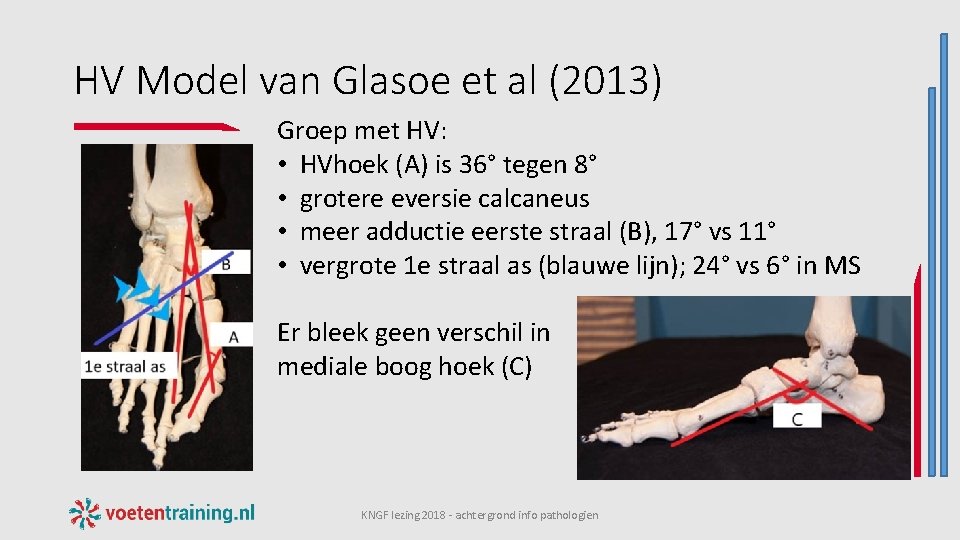 HV Model van Glasoe et al (2013) Groep met HV: • HVhoek (A) is
