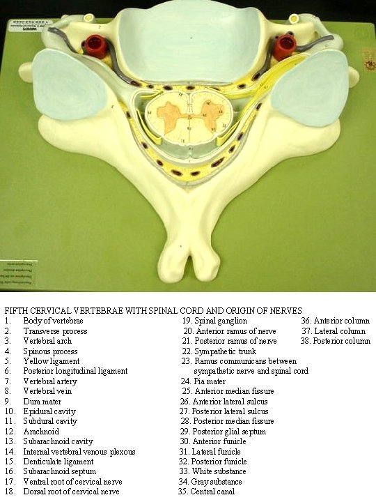 FIFTH CERVICAL VERTEBRAE WITH SPINAL CORD AND ORIGIN OF NERVES 1. Body of vertebrae