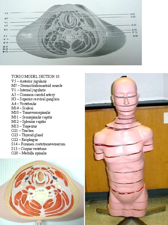 TORSO MODEL SECTION 10 V 5 – Anterior jugularis M 7 – Sternocleidomastoid muscle