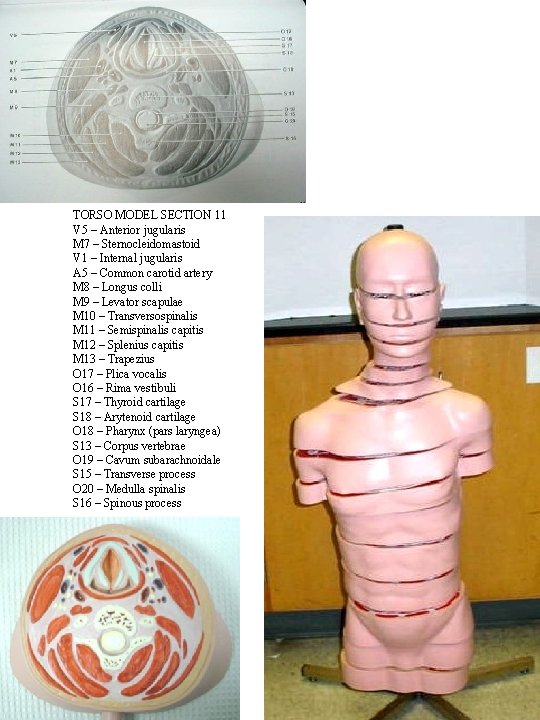 TORSO MODEL SECTION 11 V 5 – Anterior jugularis M 7 – Sternocleidomastoid V