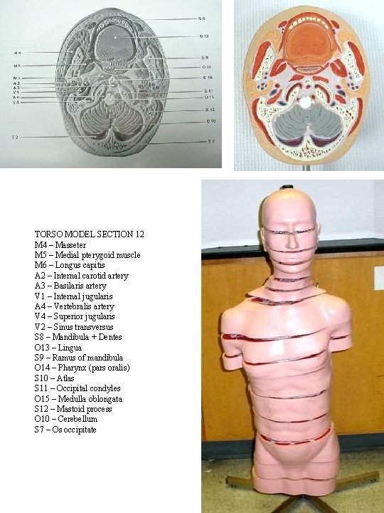 TORSO MODEL SECTION 12 M 4 – Masseter M 5 – Medial pterygoid muscle