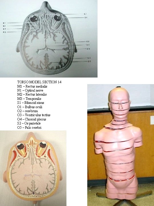 TORSO MODEL SECTION 14 M 1 – Rectus medialis N 1 – Optical nerve