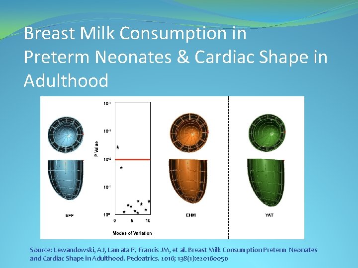 Breast Milk Consumption in Preterm Neonates & Cardiac Shape in Adulthood Source: Lewandowski, AJ,
