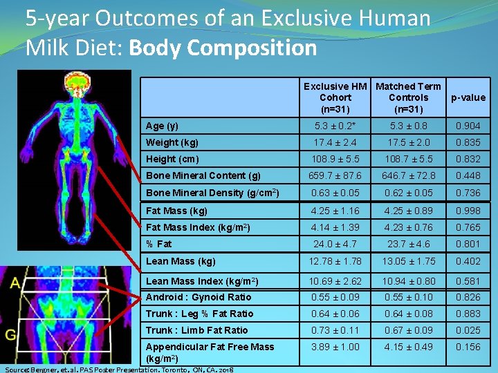 5 -year Outcomes of an Exclusive Human Milk Diet: Body Composition Exclusive HM Matched