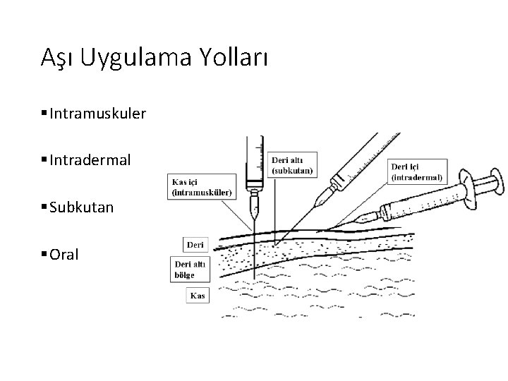 Aşı Uygulama Yolları § Intramuskuler § Intradermal § Subkutan § Oral 