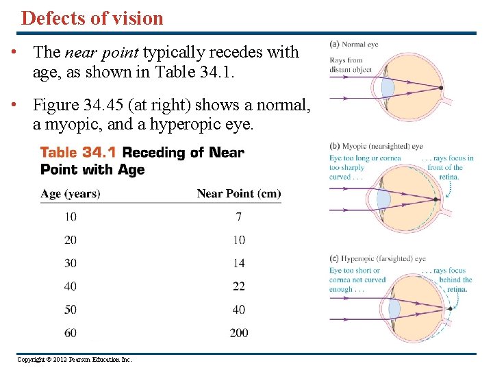 Defects of vision • The near point typically recedes with age, as shown in