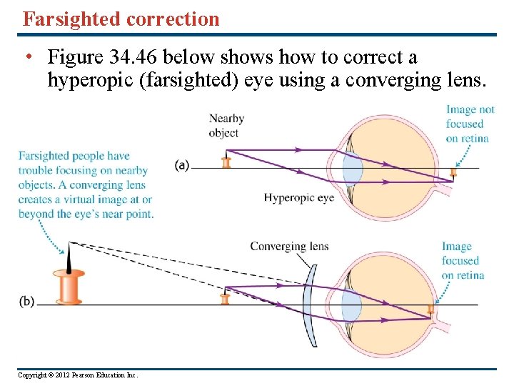 Farsighted correction • Figure 34. 46 below shows how to correct a hyperopic (farsighted)