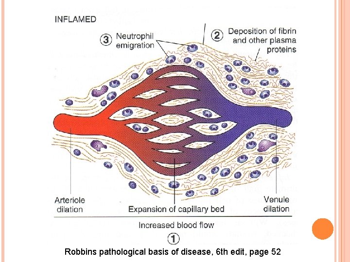 Robbins pathological basis of disease, 6 th edit, page 52 