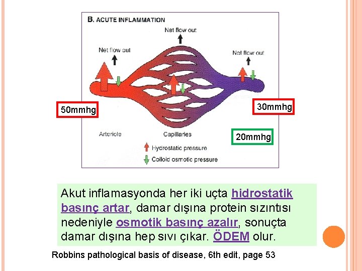 50 mmhg 30 mmhg 20 mmhg Akut inflamasyonda her iki uçta hidrostatik basınç artar,