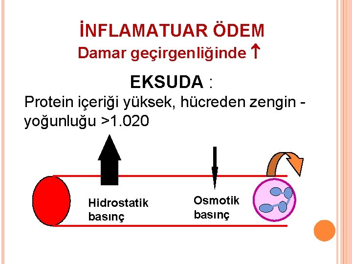 İNFLAMATUAR ÖDEM Damar geçirgenliğinde EKSUDA : Protein içeriği yüksek, hücreden zengin yoğunluğu >1. 020