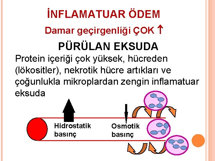 İNFLAMATUAR ÖDEM Damar geçirgenliği ÇOK PÜRÜLAN EKSUDA Protein içeriği çok yüksek, hücreden (lökositler), nekrotik