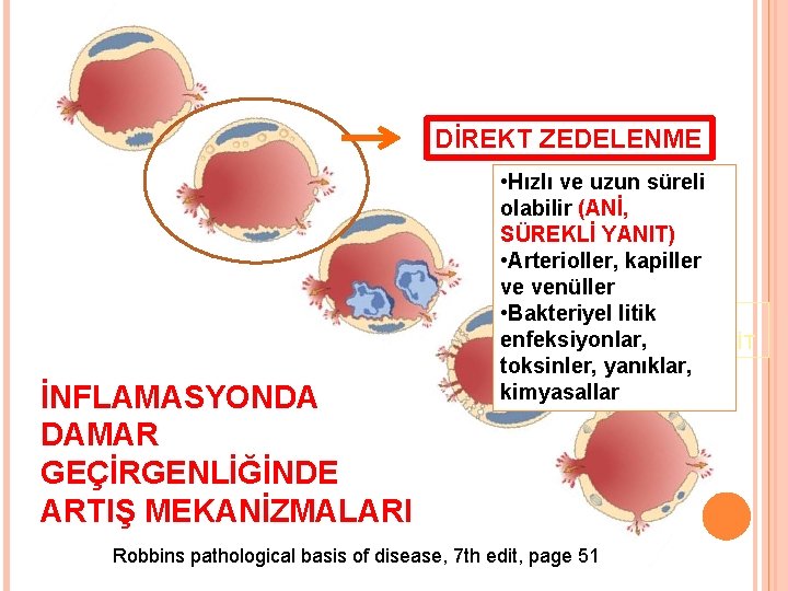 DİREKT ZEDELENME İNFLAMASYONDA DAMAR GEÇİRGENLİĞİNDE ARTIŞ MEKANİZMALARI • Hızlı ve uzun süreli olabilir (ANİ,