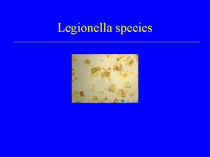 Legionella species 