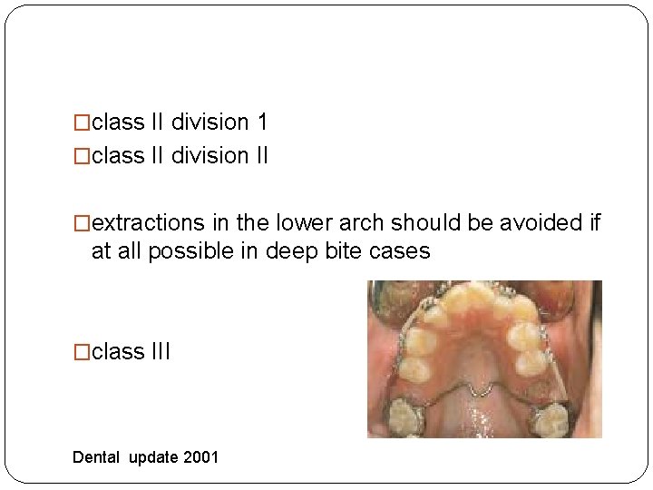 �class II division 1 �class II division II �extractions in the lower arch should