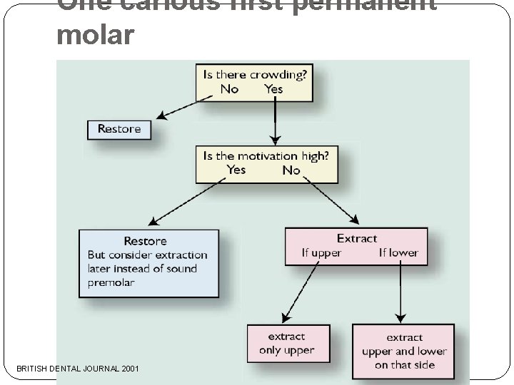 One carious first permanent molar BRITISH DENTAL JOURNAL 2001 