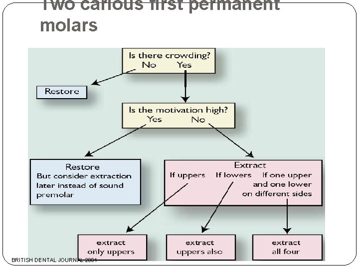 Two carious first permanent molars BRITISH DENTAL JOURNAL 2001 