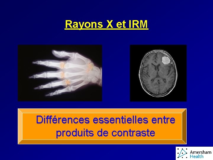 Rayons X et IRM Différences essentielles entre produits de contraste 