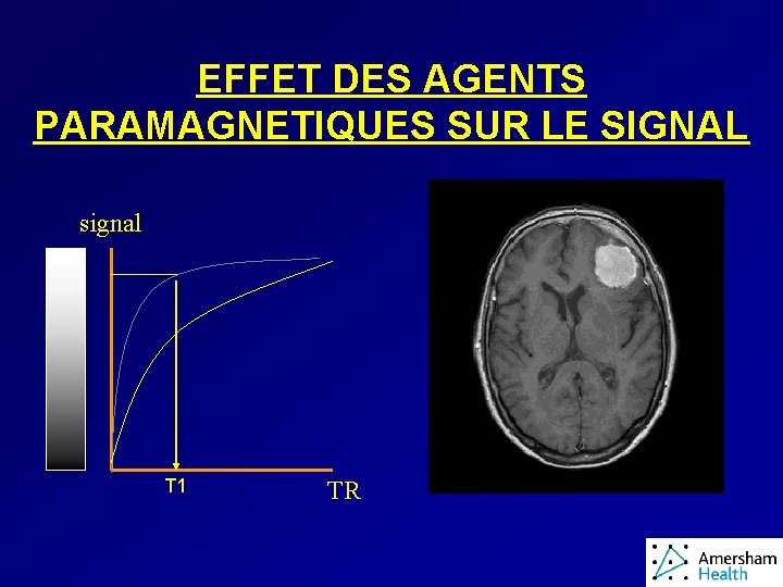 EFFET DES AGENTS PARAMAGNETIQUES SUR LE SIGNAL signal T 1 TR 