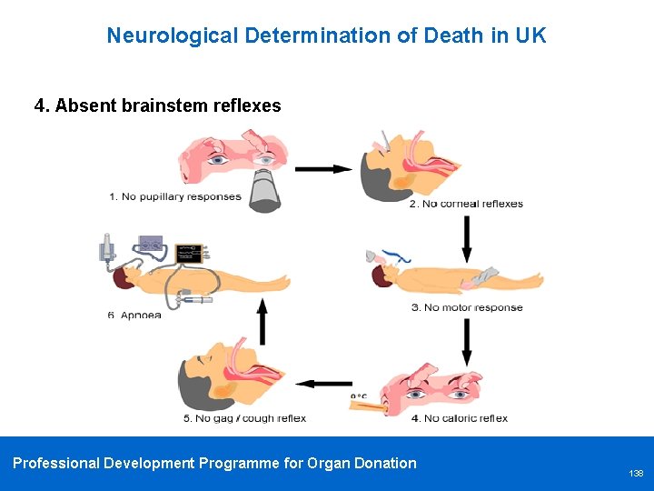 Neurological Determination of Death in UK 4. Absent brainstem reflexes Professional Development Programme for