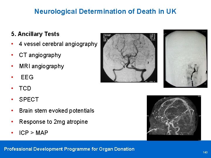 Neurological Determination of Death in UK 5. Ancillary Tests • 4 vessel cerebral angiography