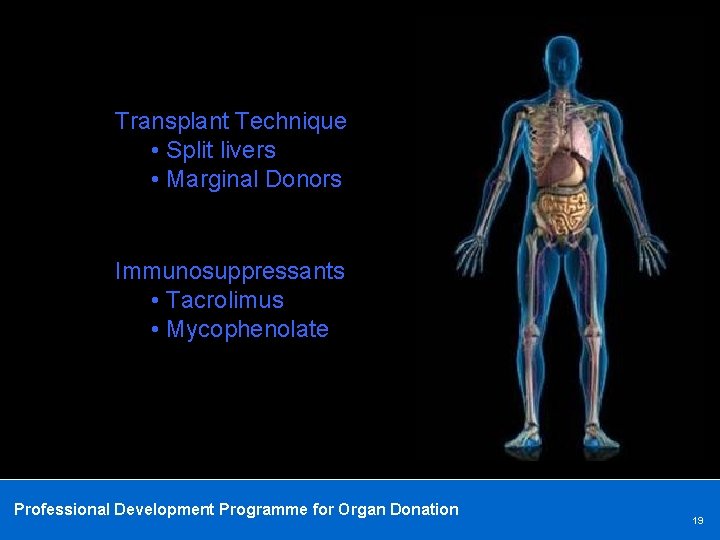 Transplant Technique • Split livers • Marginal Donors Immunosuppressants • Tacrolimus • Mycophenolate Professional