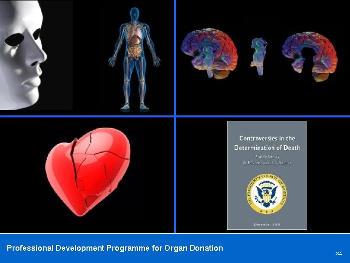 Professional Development Programme for Organ Donation 34 