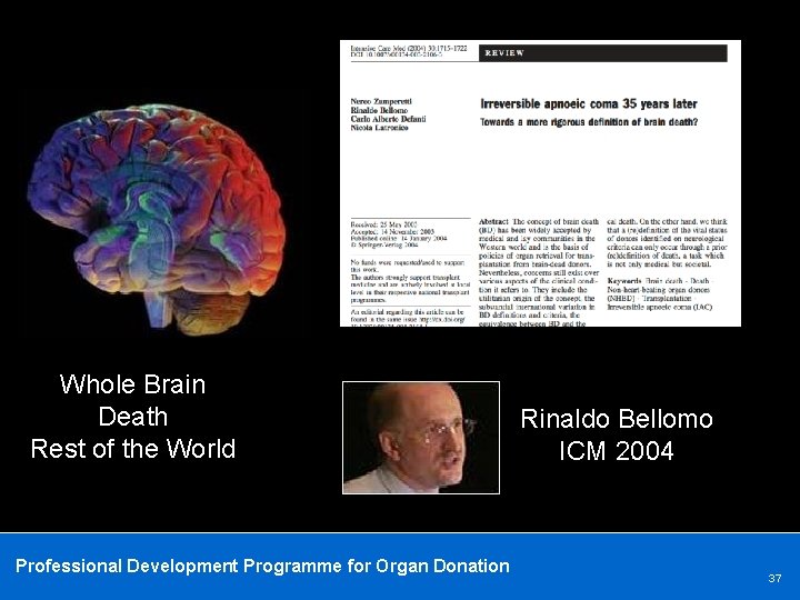 Whole Brain Death Rest of the World Professional Development Programme for Organ Donation Rinaldo