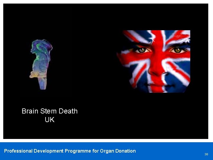 Brain Stem Death UK Professional Development Programme for Organ Donation 38 