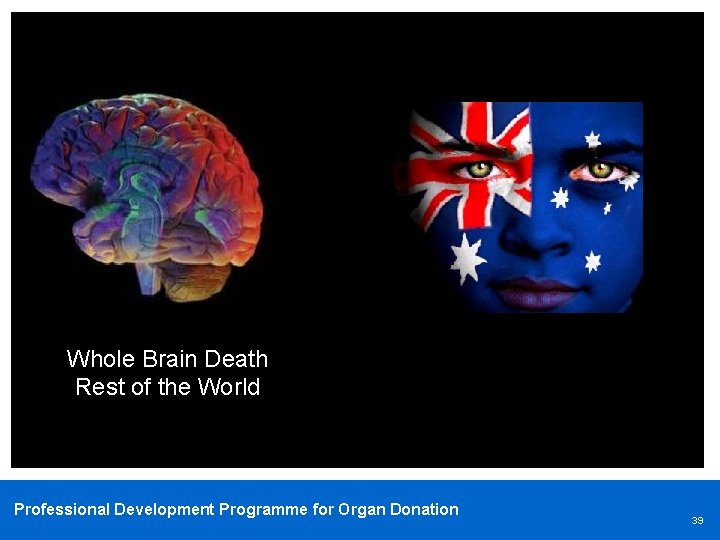 Whole Brain Death Rest of the World Professional Development Programme for Organ Donation 39