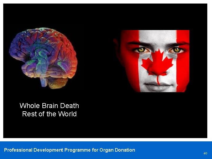 Whole Brain Death Rest of the World Professional Development Programme for Organ Donation 40