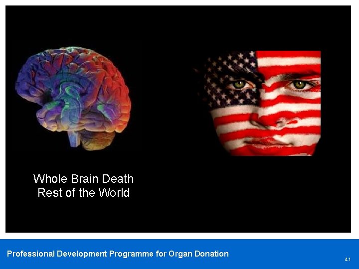 Whole Brain Death Rest of the World Professional Development Programme for Organ Donation 41