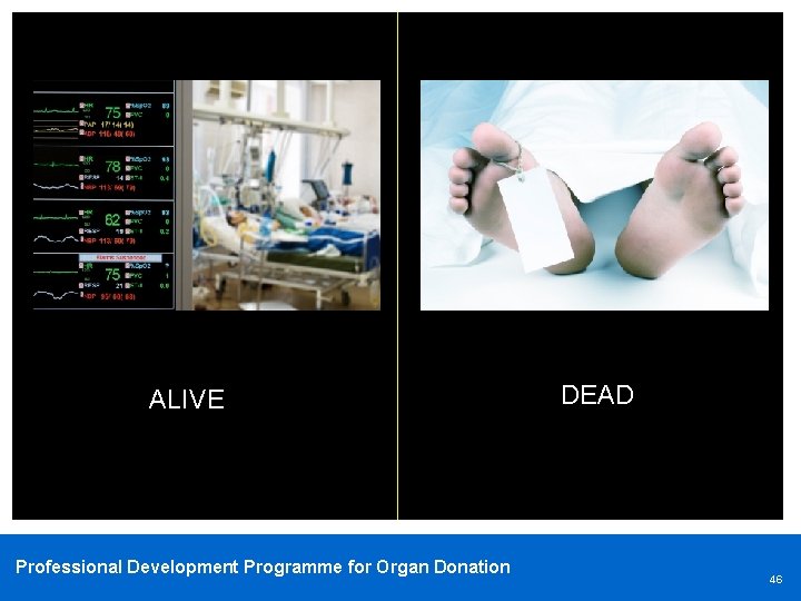 ALIVE Professional Development Programme for Organ Donation DEAD 46 