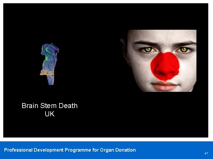 Brain Stem Death UK Professional Development Programme for Organ Donation 47 