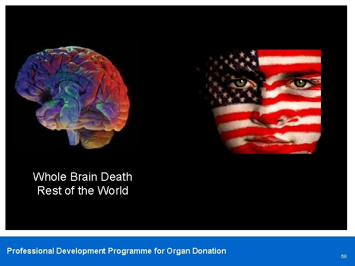 Whole Brain Death Rest of the World Professional Development Programme for Organ Donation 58